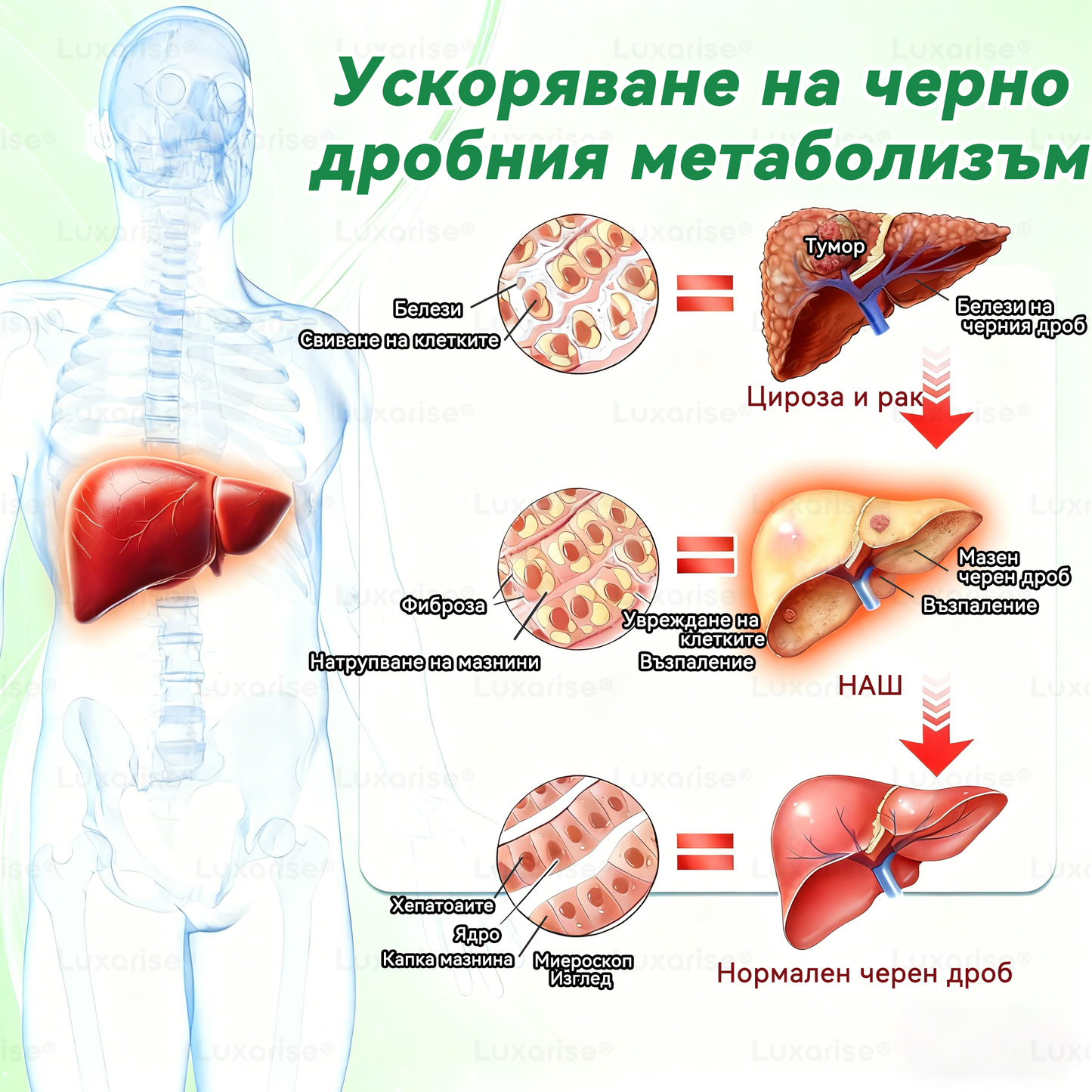Официален магазин | 🧑‍⚕️𝗟𝘂𝘅𝗮𝗿𝗶𝘀𝗲® МОРИНГА Х БЕРБЕРИН 10-IN-1 Напреднал Нано Микроигли Пластир (Веднъж дневно, видими резултати след 7 дни) ✅ Подходящ при: затлъстяване, диабет, сънна апнея и проблеми със ставите 🍀